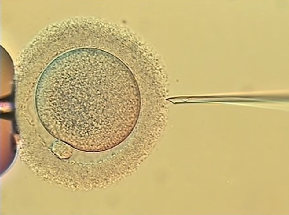 Científicos de Florida crean chip para separar los espermatozoides "buenos"